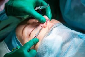 Can Endoscopic Sinus Surgery (FESS) Improve Sleep Quality? Benefits, Recovery, and Finding the Right ENT