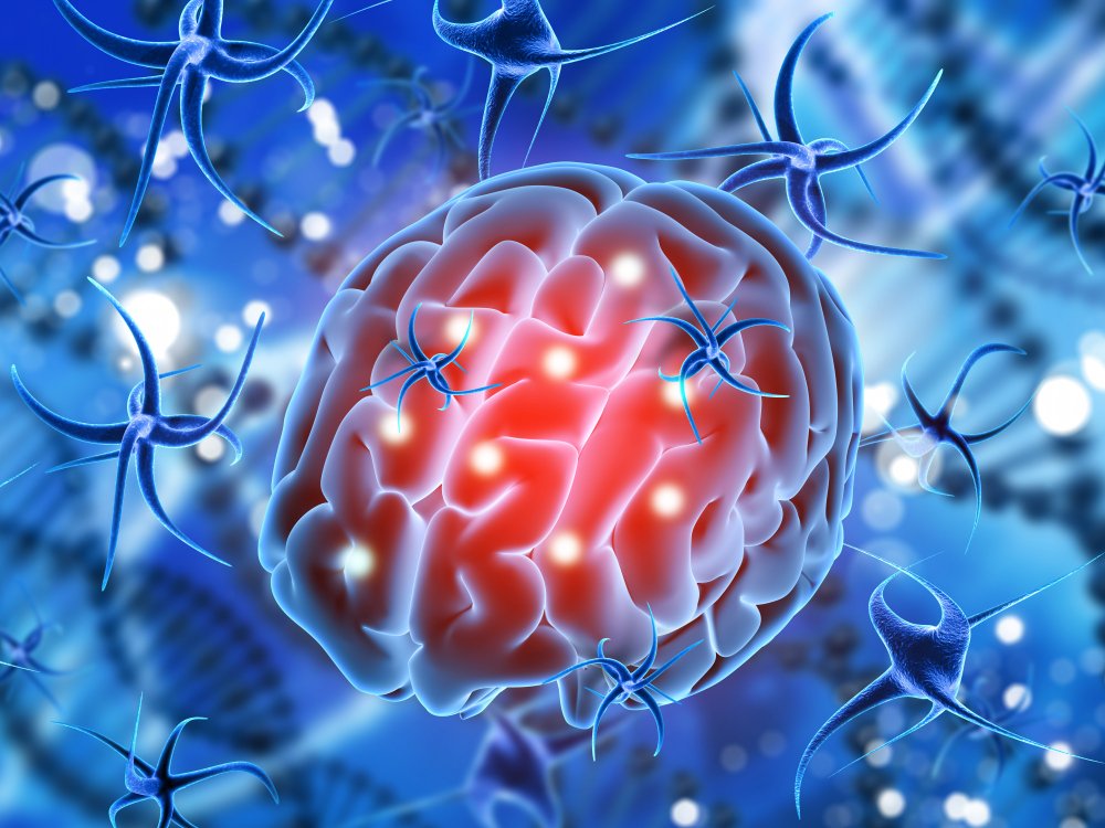 Autoimmune Disorders