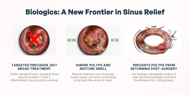 Chronic Rhinosinusitis - Sinus Relief