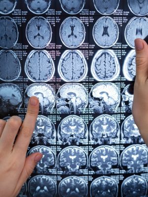 brain-scan